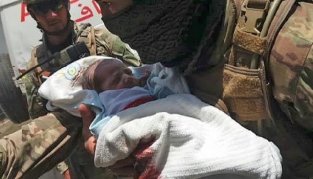 مقتل 14 مدنيا بينهم أطفال في هجوم على مستشفى بأفغانستان