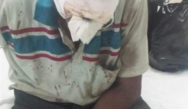 المجني عليه 
