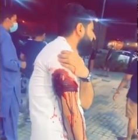 الشاب عصام المعتدى عليه في السعودية