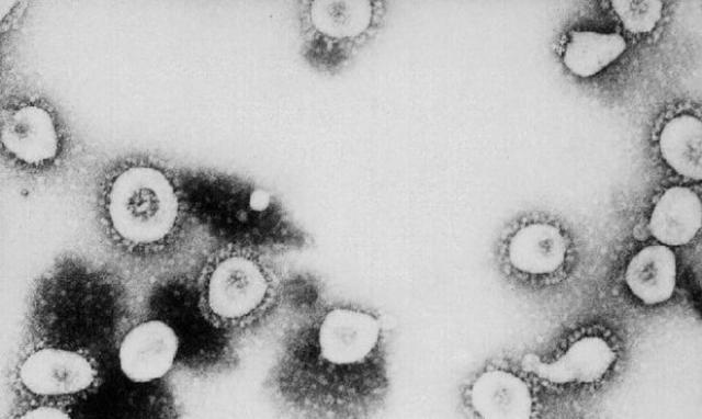 علماء صينيون يلتقطون صورا دقيقة لفيروس كورونا: يمكنها أن تساعد في الوصول للقاح