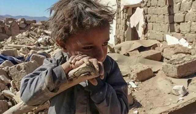 الأزمةالإنسانية في اليمن