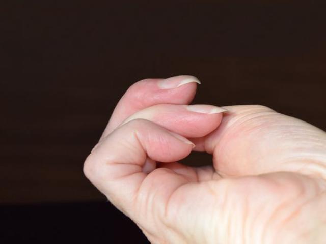 علامة تظهر على الأصابع قد تشير إلى إصابتك بسرطان الرئة