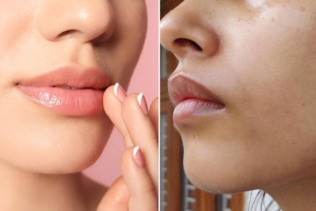 طرق التخلص من البقع الداكنة حول الفم