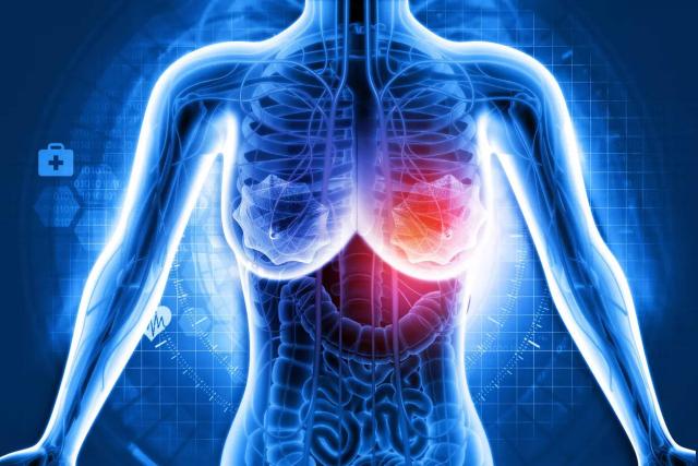 عقار جينى جديد يزيد من فرص الحياة لمرضى سرطان الثدى
