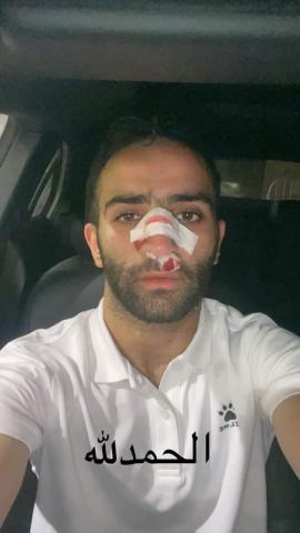 لاعب المصري يتعرض لكسر في الأنف