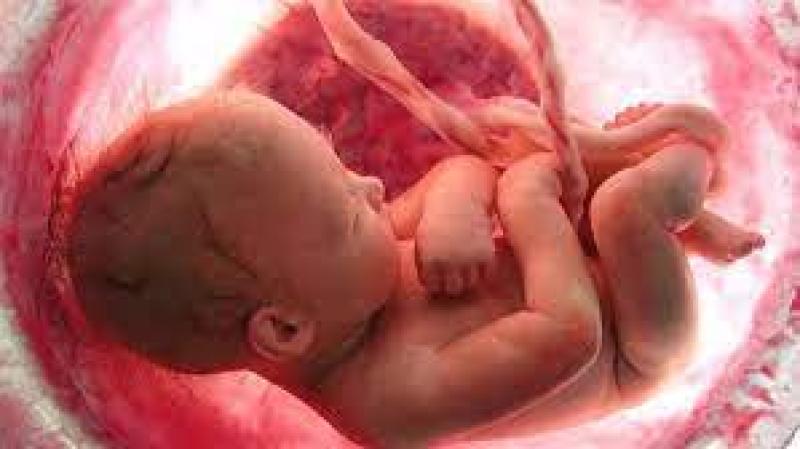 «ثاني حالة بمصر».. طبيب يكشف السبب وراء ولادة طفلة بداخل بطنها جنين