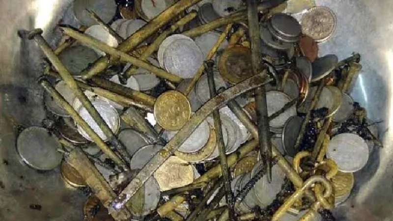 رجل يبتلع 63 قطعة نقود معدنية.. فما القصة؟