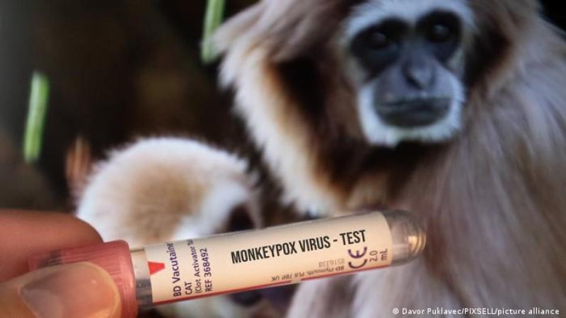 جدري القرود.. كل ما تريد معرفته عن الفيروس بعد ظهوره في مصر