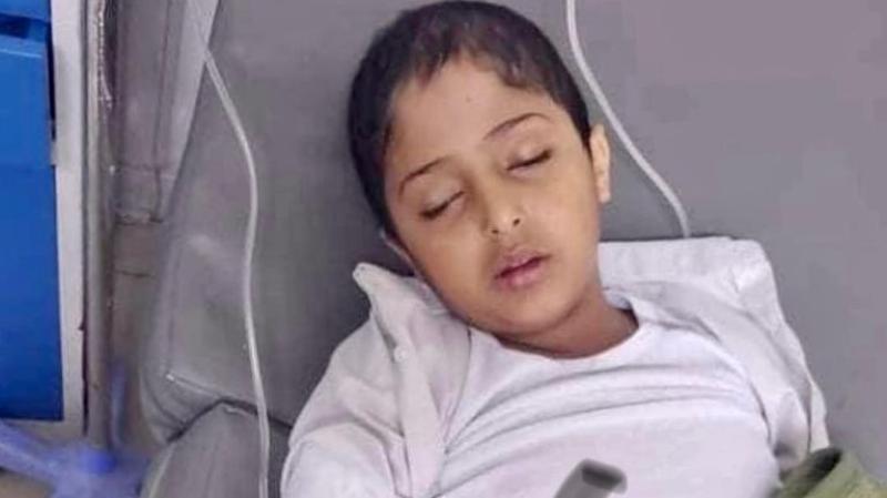 طفل يمني مصاب بالسرطان ـ العين الإخبارية