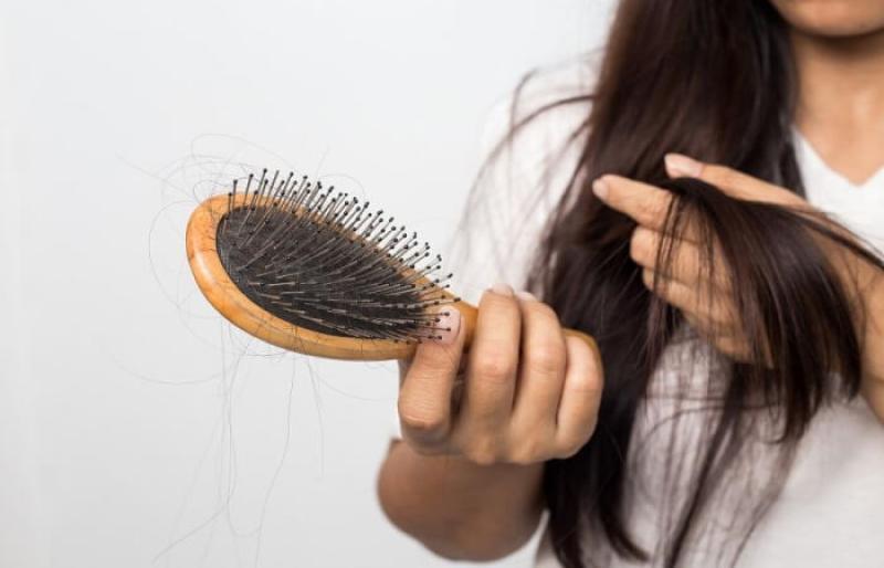 تساقط الشعر - مصدر الصورة / ياندكس