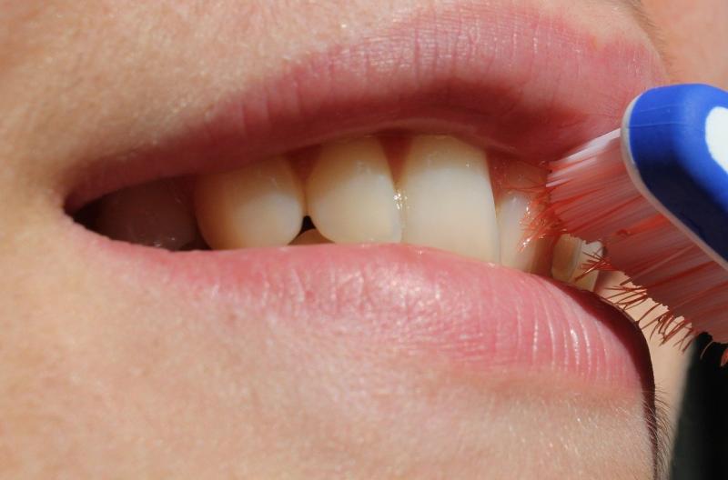 امراض الفم والاسنان 