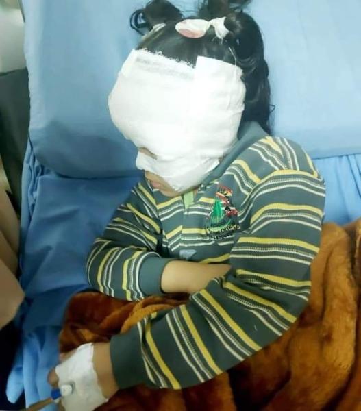 تحطم رأس طفلة في أسيوط -سوشيال ميديا 