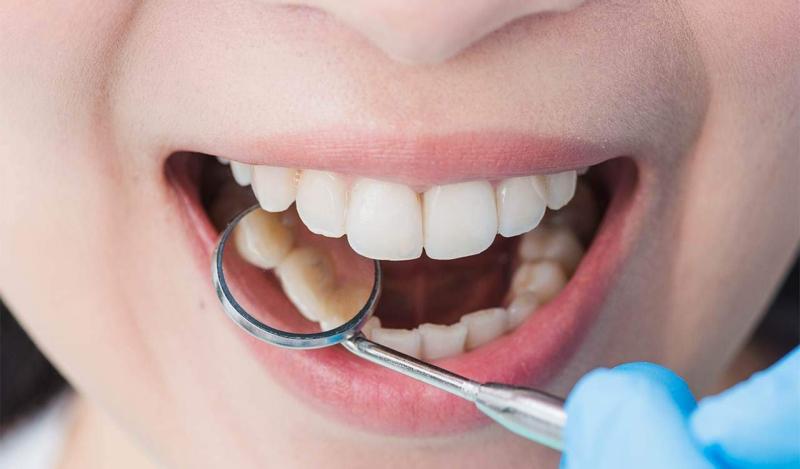 مشكلات الفم والأسنان
