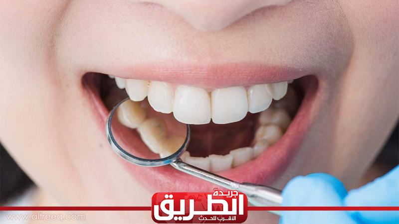 كيف يحدث تسوس الأسنان؟ الصحة تجيب الأخبار الطريق