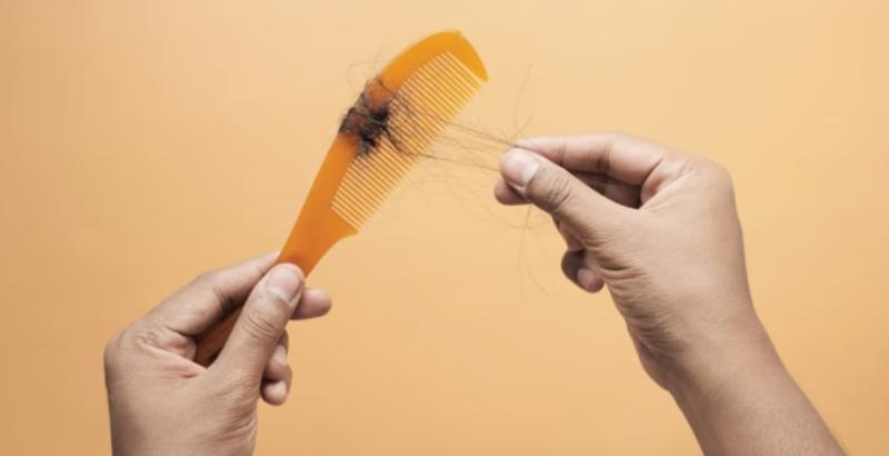 استشاري تكشف لـ«الطريق» تأثير الإصابة بالسكري على الشعر