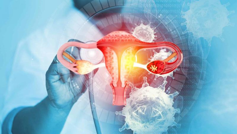 الصحة: سرطان الرحم يقتل امرأة كل دقيقتين حول العالم