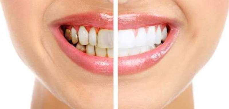 طرق طبيعية فعالة في العناية بالأسنان 