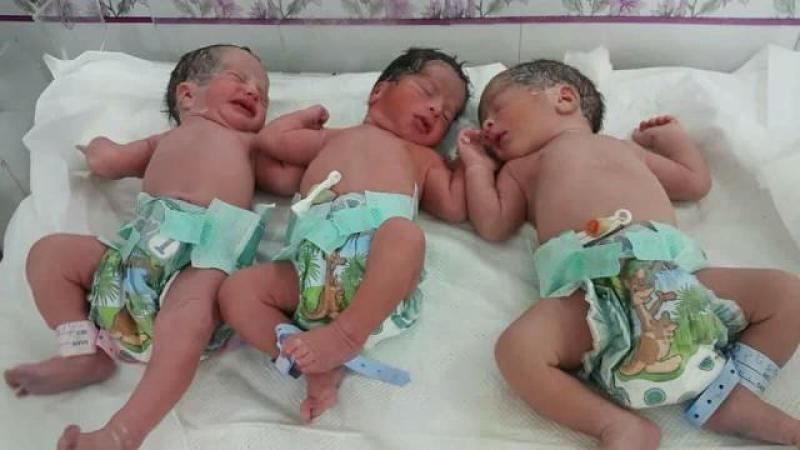 قبل انفجار الرحم.. نجاح ولادة 3 توائم بمستشفى الباجور في المنوفية