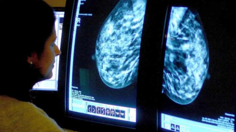 تشخيص سرطان الثدي بالذكاء الاصطناعي_مصدر الصورة_الجارديان