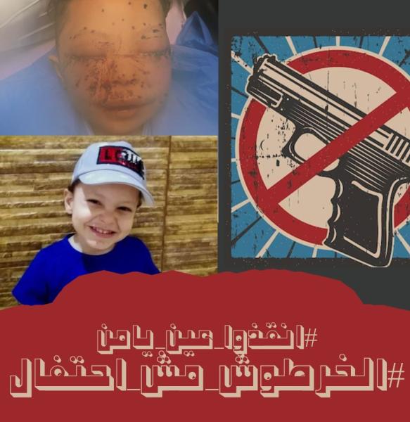 انقذوا عين يامن.. حملة لإنقاذ طفل ضحية خرطوش مستخدم في زفة عروسين