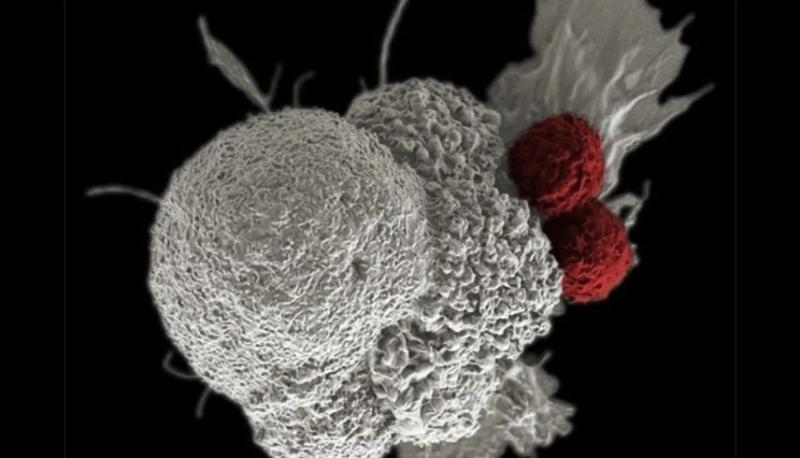 تقنية جديدة لتحفيز الجهاز المناعي لمحاربة السرطان بسهولة