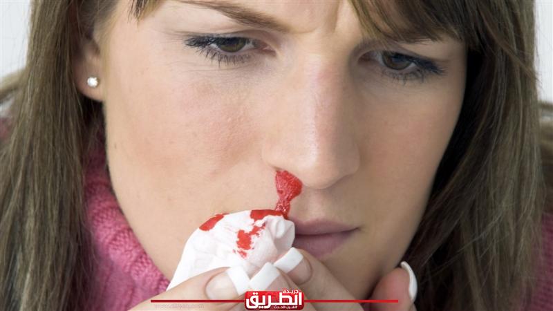 دراسة تكشف عن أسباب نزيف الأنف وطرق علاجه | المنوعات | الطريق