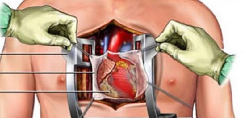 موافي يطمئن من يجري عملية القلب المفتوح: أطباء مصر شاطرين جدا