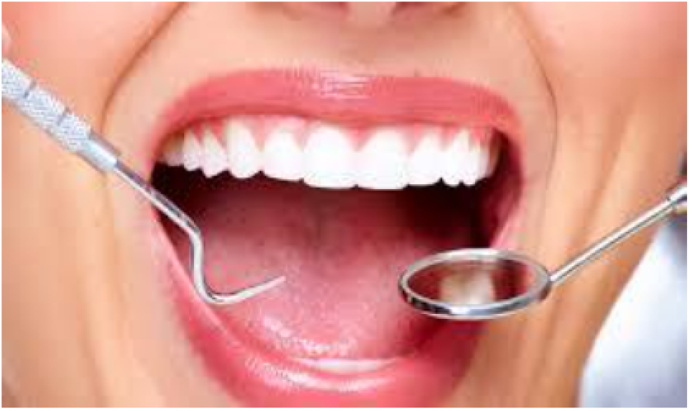 تجميل الأسنان باستخدام الفينير مع مراكز كلينيكا للاسنان