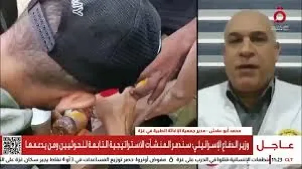 شاهد| مدير جمعية الإغاثة الطبية في غزة: استهداف متعمد للجائعين خلال استلام المساعدات الإنسانية