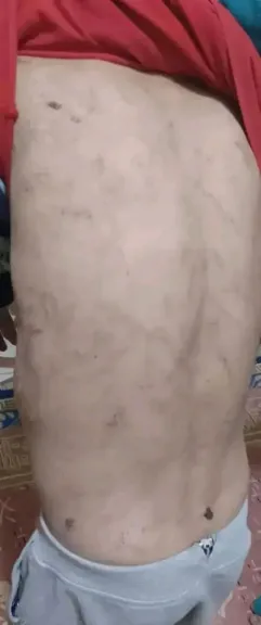 تعذيب طفل علي يد مرات الأب 