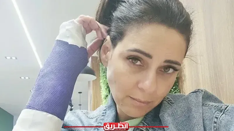 الفنانة نورهان تقلق جمهورها بعد إصابة يدها: «لا مفر من الجبس»